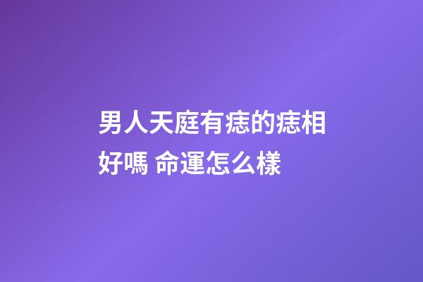 男人天庭有痣的痣相好嗎 命運怎么樣